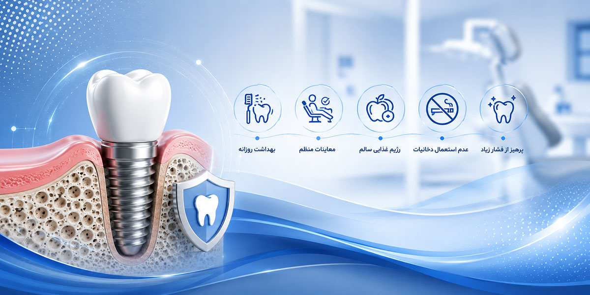 چگونه ایمپلنت سالم  داشته باشیم ؟